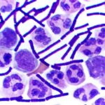 Gram_Stain_Anthrax